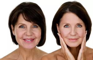 rosto-de-mulher-bonita-mais-de-55-anos-antes-e-depois-Lifting-facial.png